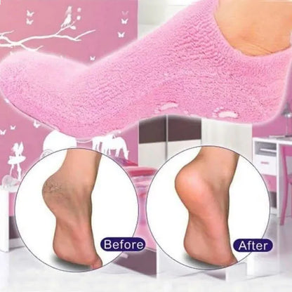 SpaGel™ | Spa Gel Socks Moisturizing - Shop1